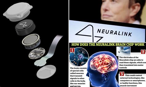 nanobots rfid chip|Elon Musk's Neuralink Has Implanted Its First Chip in a Human .